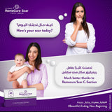 REMECURE SCAR C SECTION SCAR THERAPY 2 SHEETS